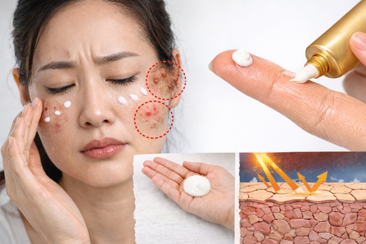 Chống nắng kh&ocirc;ng đ&uacute;ng c&ograve;n nguy hiểm hơn kh&ocirc;ng chống